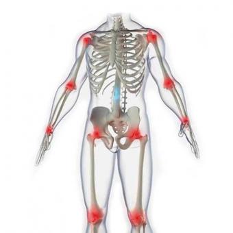 Set 2x RXB COMPLEX bei Muskel- und Gelenkschmerzen (2x30 Kapseln)
