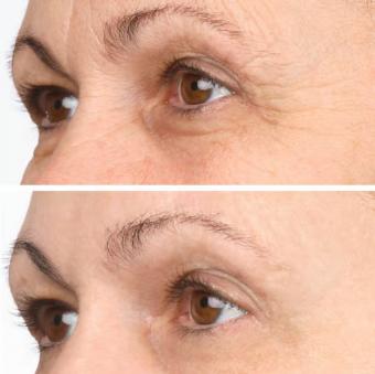 Vitame Collagen Plus 1+1 Aktion – doppelte Schönheitspflege von innen (2x90 Kapseln)