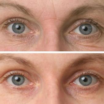 Vitame Collagen Plus 1+1 Aktion – doppelte Schönheitspflege von innen (2x90 Kapseln)