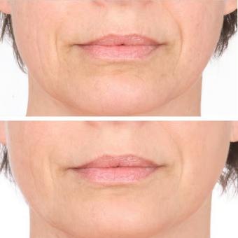 Vitame Collagen Plus 1+1 Aktion – doppelte Schönheitspflege von innen (2x90 Kapseln)